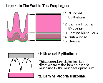 direction of secondary distortion