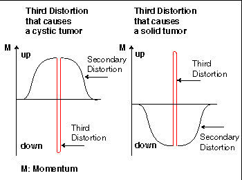 solid and cystic tumor