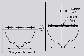 Fractalism and Tumorigenesis